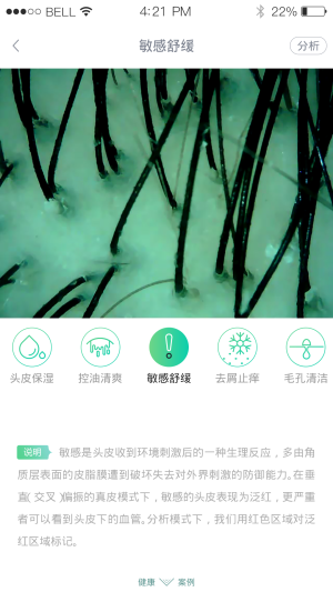 olaizyappD4